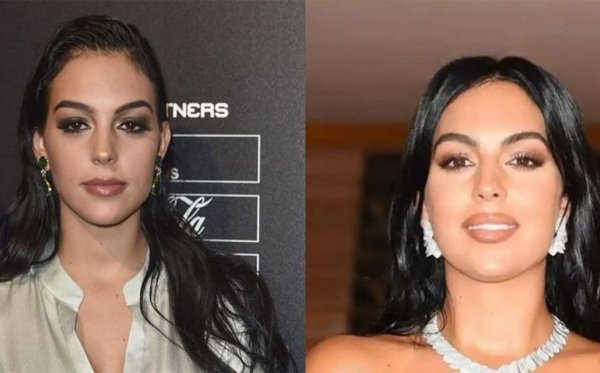  عکس جورجینا رودریگز قبل از عمل