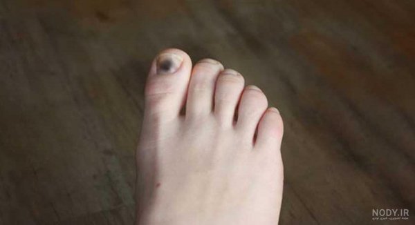  عکس لاک زدن رونالدو