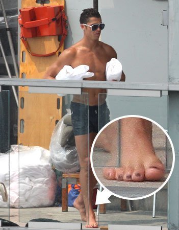 عکس پای مسی