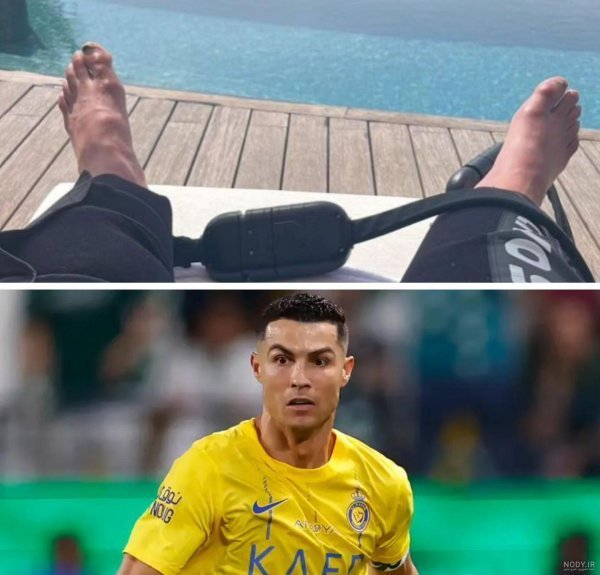 عکس پای مسی