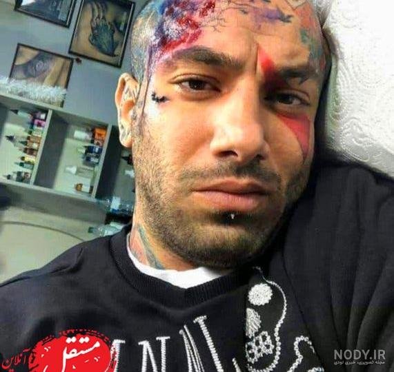  عکس چشم امیر تتلو