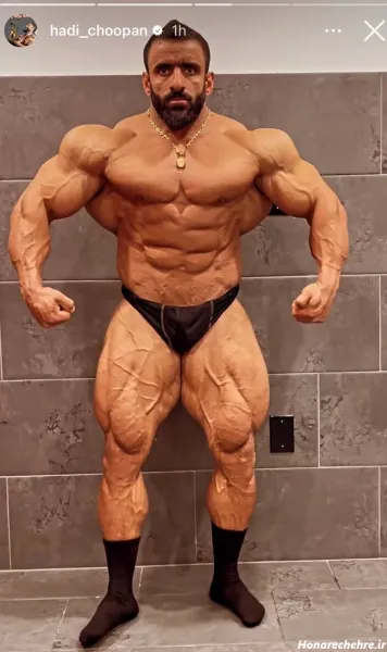  عکس هادی چوپان با همسرش