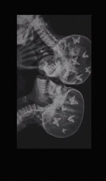  عکس های عاشقانه خارجی و خاک بر سری