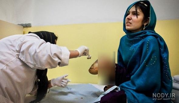  عکس دختر افغانی ساده 17 ساله