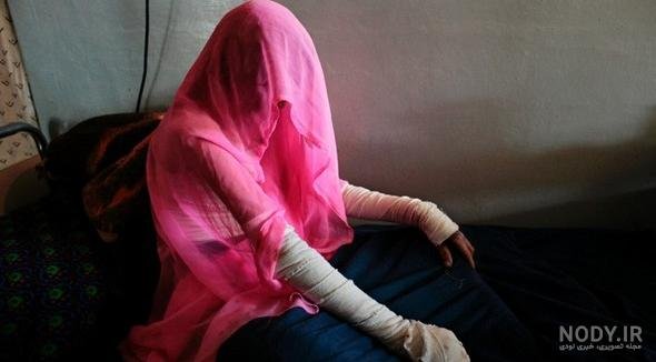  عکس دختر افغانی ساده 17 ساله