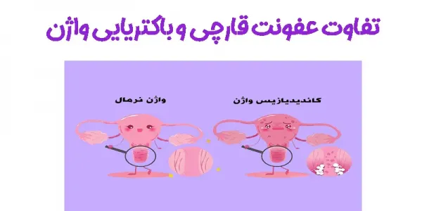  عکس انواع عفونت واژن