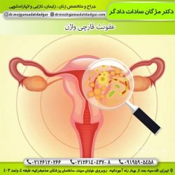  عکس واقعی عفونت قارچی واژن نی نی سایت