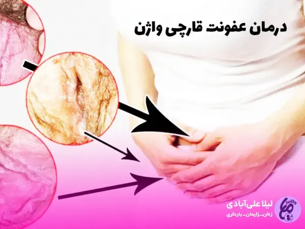  عکس عفونت واژن
