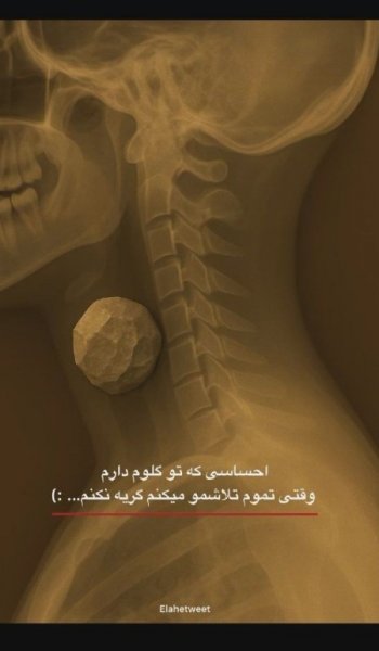  عکسهای غمگین