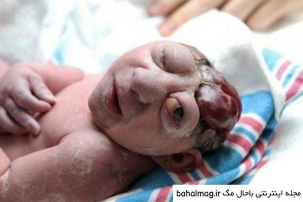  عکس ترسناک برای بچه ها