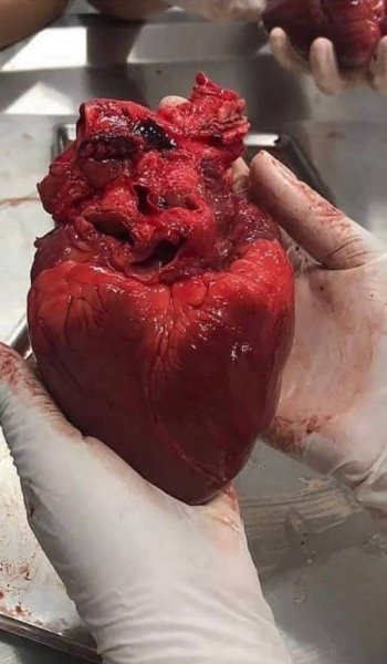  عکس عاشقانه استوری