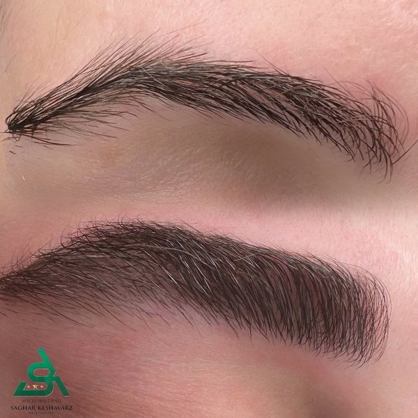 عکس میکرو ابرو قبل و بعد