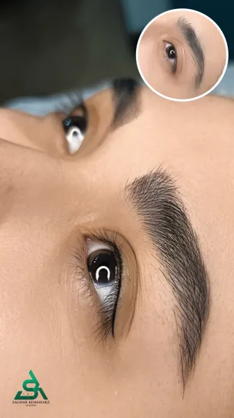  عکس میکرو ابرو قبل و بعد