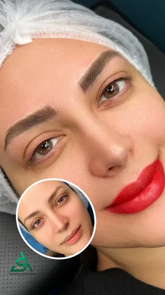  عکس میکرو ابرو قبل و بعد