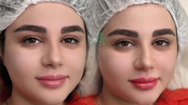  عکس میکرو ابرو قبل و بعد
