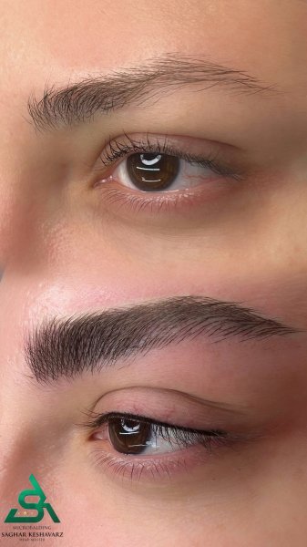  عکس میکرو ابرو قبل و بعد