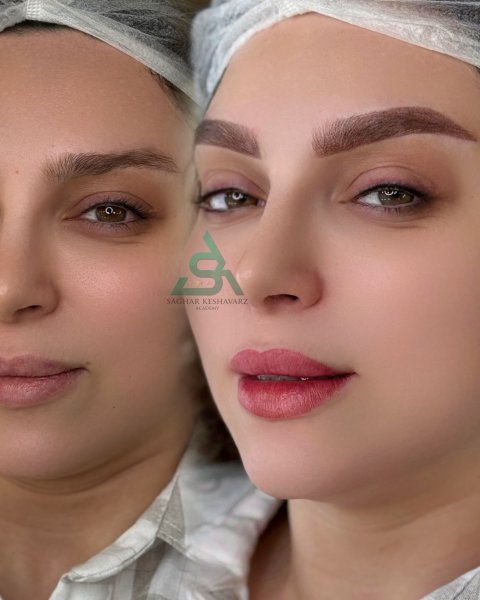  عکس میکرو ابرو قبل و بعد دخترانه
