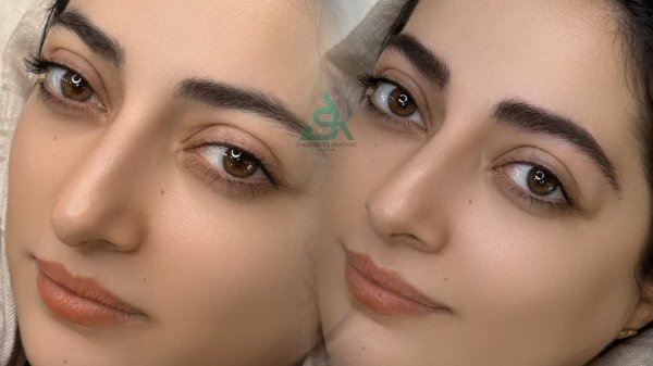  عکس میکرو ابرو قبل و بعد دخترانه