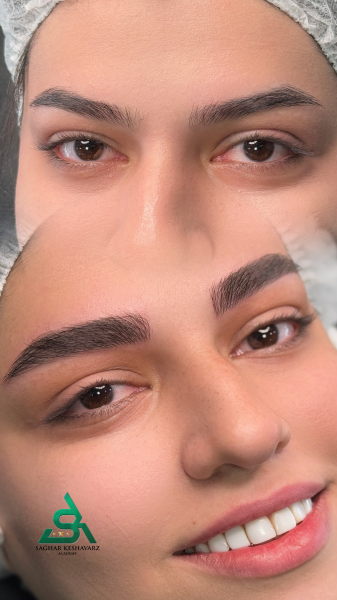  عکس میکرو ابرو قبل و بعد دخترانه