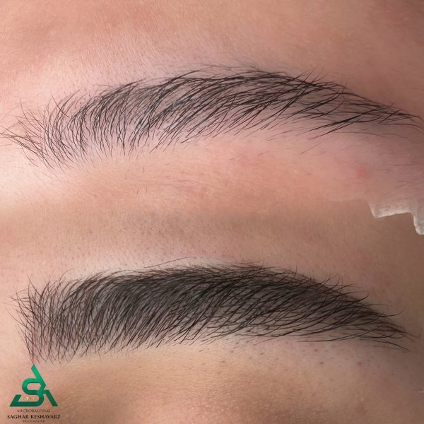  عکس میکرو ابرو قبل و بعد دخترانه