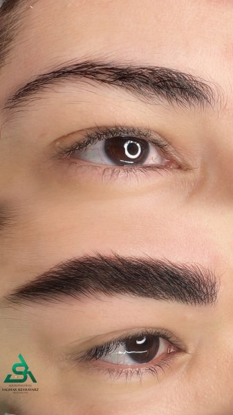  عکس میکرو ابرو قبل و بعد دخترانه