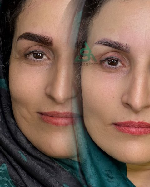  50 عکس میکرو ابرو بعد از یک ماه