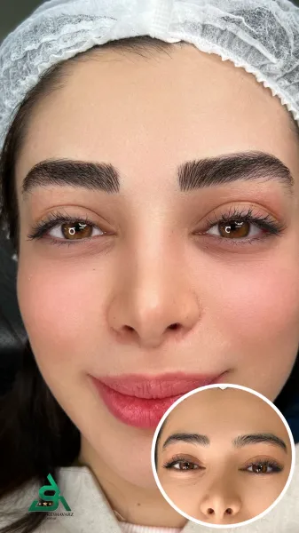  49 عکس میکرو ابرو بعد از یک هفته