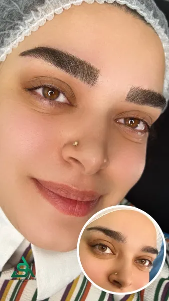  عکس میکرو ابرو بعد از یکسال
