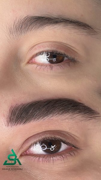  عکس میکرو ابرو بعد از یکسال