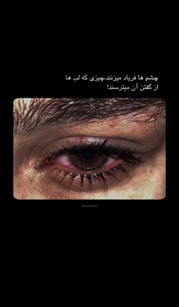  عکس چشم