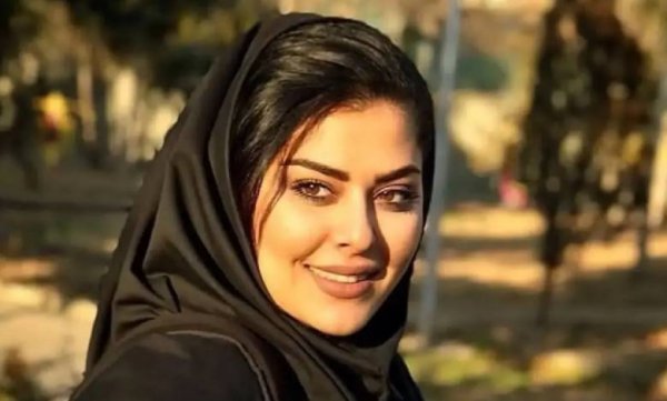  مدل مو جلو سر کوتاه