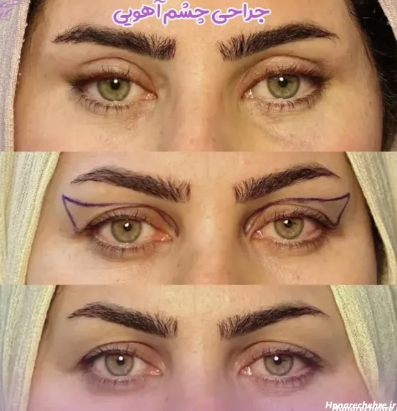  عکس چشم آهویی