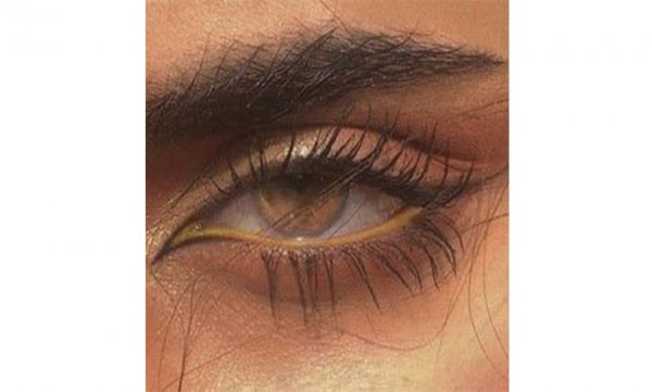  عکس چشم روباهی