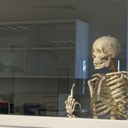  عکس های ترند اسکلت