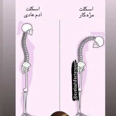  عکس اسکلت سیاه