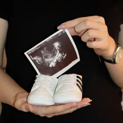  عکس بارداری اسپرت