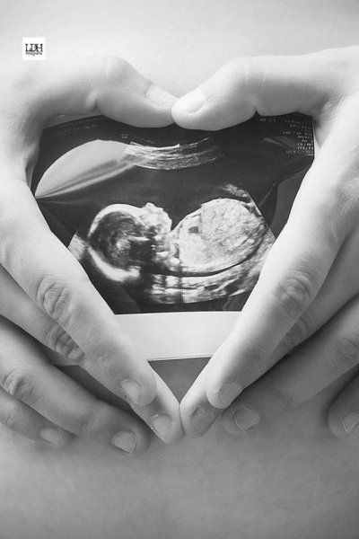  عکس بارداری فانتزی