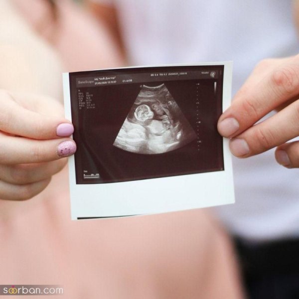  ژست عکس بارداری ایرانی