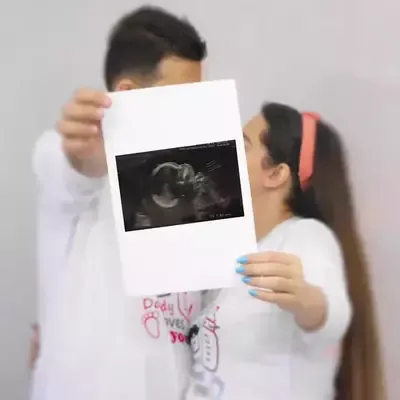  عکس بارداری جدید