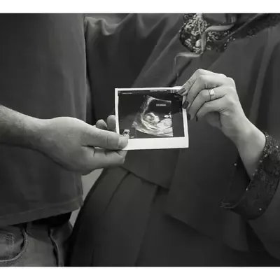  عکس بارداری جدید