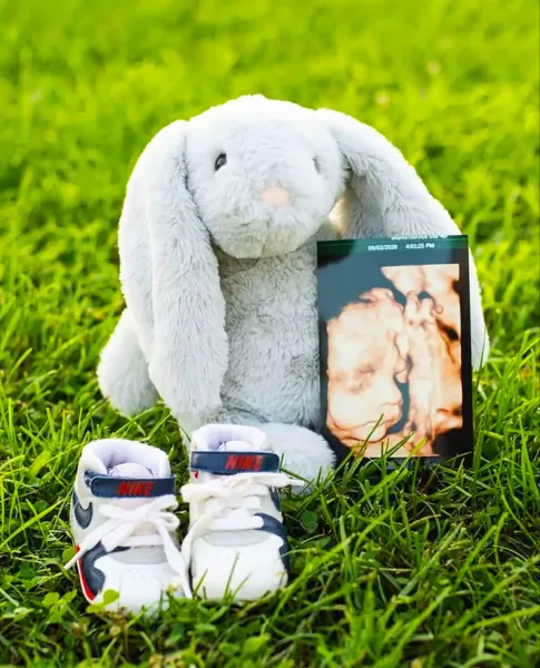  ایده عکس بارداری با عکس سونوگرافی