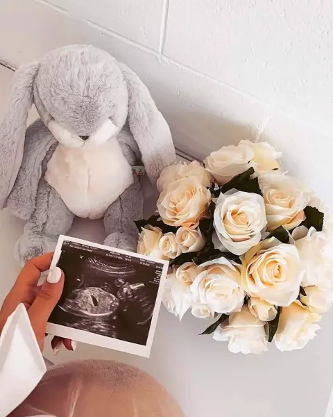  ایده عکس بارداری با عکس سونوگرافی