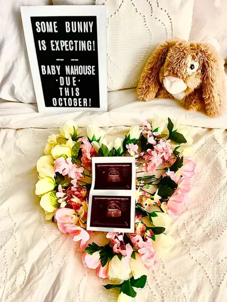  ایده عکس بارداری با عکس سونوگرافی