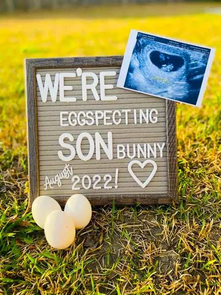  ایده عکس بارداری با عکس سونوگرافی