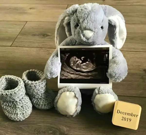  ایده عکس بارداری با عکس سونوگرافی