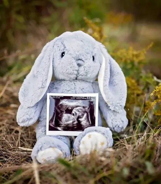  ایده عکس بارداری با عکس سونوگرافی