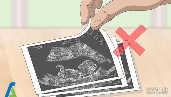  عکس سونوگرافی برای استوری