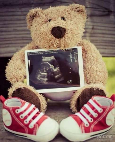  عکس سونوگرافی برای استوری