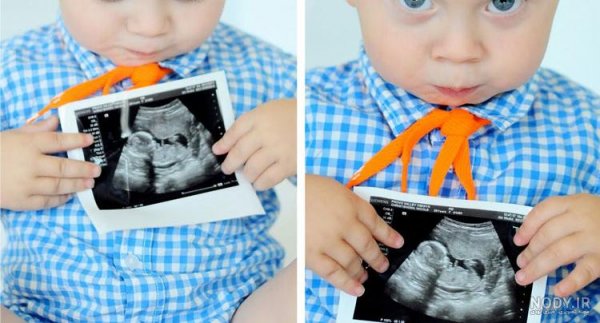  عکس سونوگرافی برای استوری