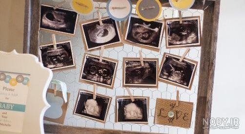  عکس سونوگرافی برای استوری